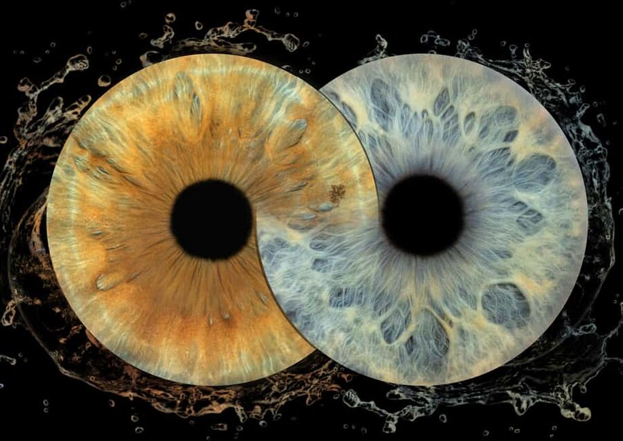IRIS Photography (macro photo of your eye) - What happens during the 10-minute session